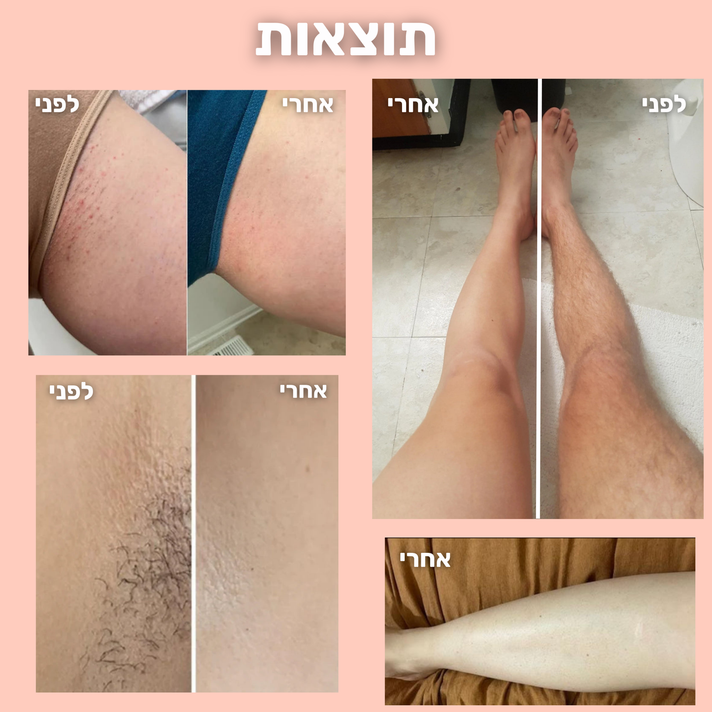 מכונת הלייזר של LUNERE